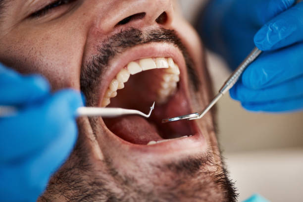 Best Full Mouth Reconstruction  in Cambridge, OH